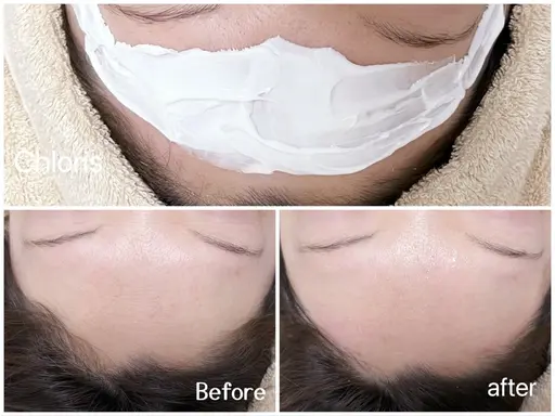 【初回限定】 角質ざらざらケア【韓国美肌wax】フェイシャルワックス