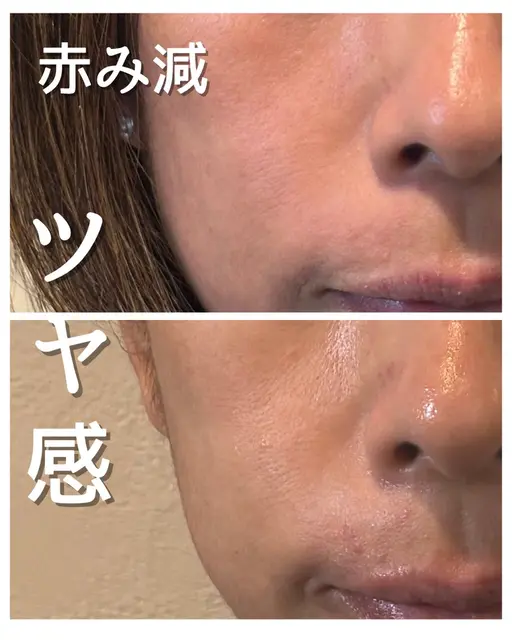 ハリ実感✨フェイシャル　チェアエステ　90分