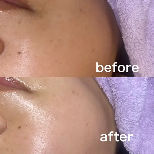 内側から発光するお肌へ~フェイシャルワックス~