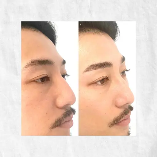 メンズアイブロウスタイリング/ワックス脱毛&毛量調整