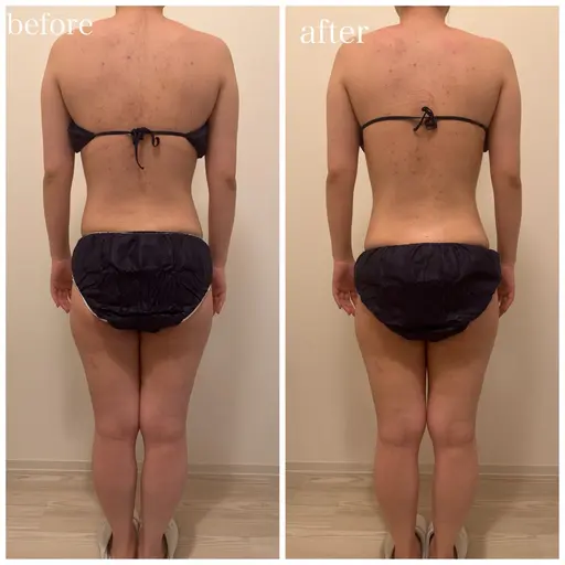 【ミニモ限定】一度で実感！ハイパーナイフ半身（下半身or上半身）20分¥2,980(モニター）