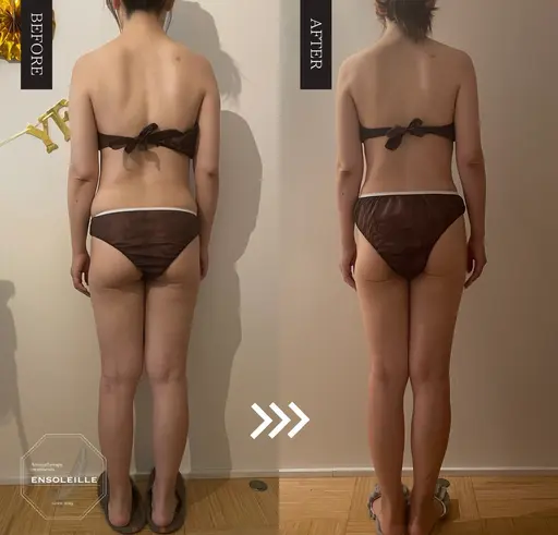 🉐【汗だくデトックス🔥ビフォーアフターで一目瞭然】よもぎ蒸し30分+脂肪温熱痩身マシンセルゼロ90分＜120分＞