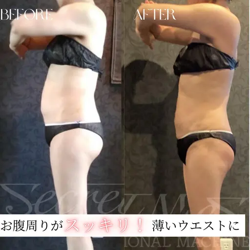 初回体験【セルフ痩身｜1部位30分】最先端痩身マシンが当て放題🔥ダイエット/冷えむくみ緩和　¥3500→¥1100