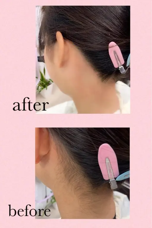 🍐うなじWax脱毛🍑気になるムダ毛無くしませんか❓ レディース&メンズ◇60分～90分