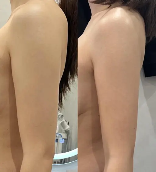 二の腕すっきり引き締めプラン リンパマッサージ45分+セレブの筋トレマシン20分 ¥3300