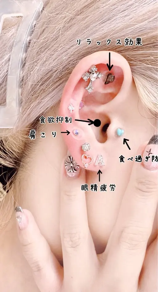 耳つぼジュエリー10粒