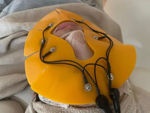 【🧡乾燥肌でお悩みの方向け徹底ケア🧡】超高保湿パック+生コラーゲン導入+細胞活性化セルサー