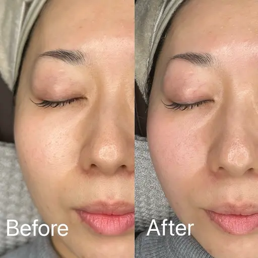 フェイスワックス(気になるところ2部位)¥3,000