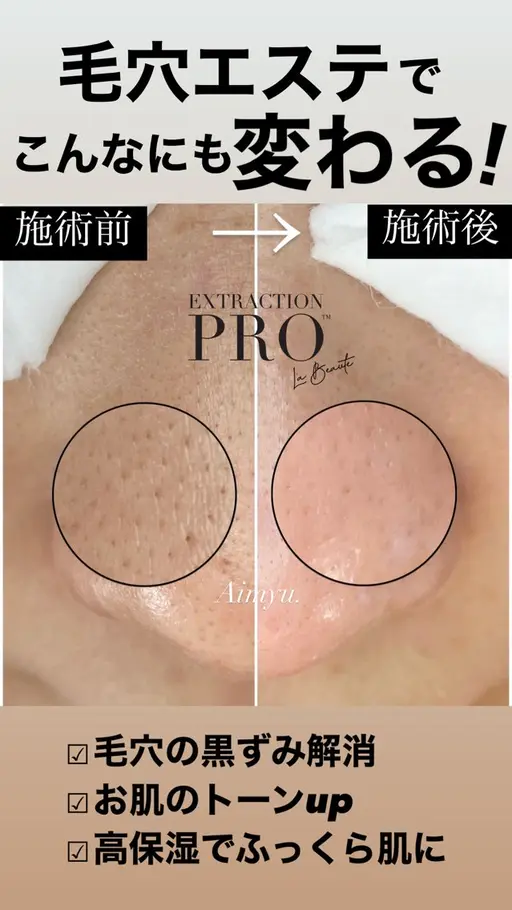 1年の感謝を込めて✨️毛穴の大掃除+癒しのデコルテマッサージを特別価格で🎁【毛穴改善コース】🫧 90分