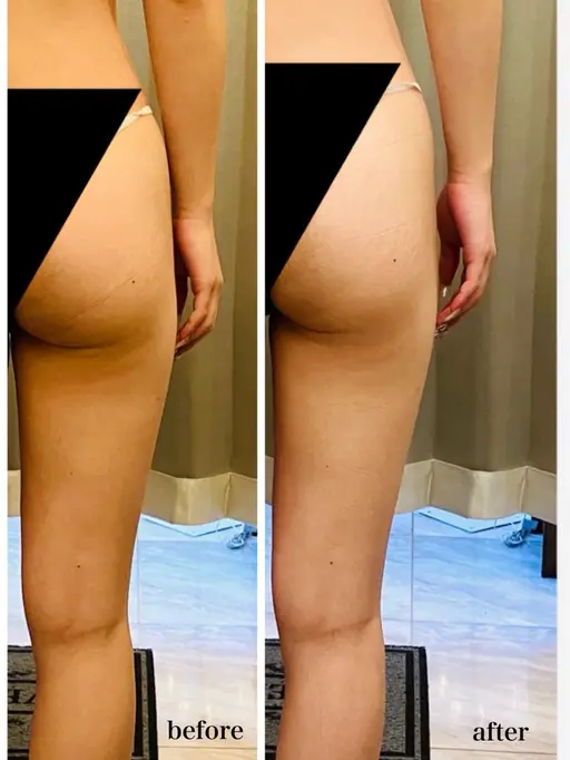 【パンツに響く“下半身の重さ”をリセット】美脚・美尻を優しく整える80分ケア。