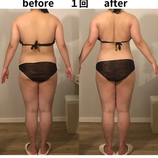 全身燃焼デトックス痩身120分🔥ラジオ波×痩身ハンドで全身むくみ・セルライト徹底ケア