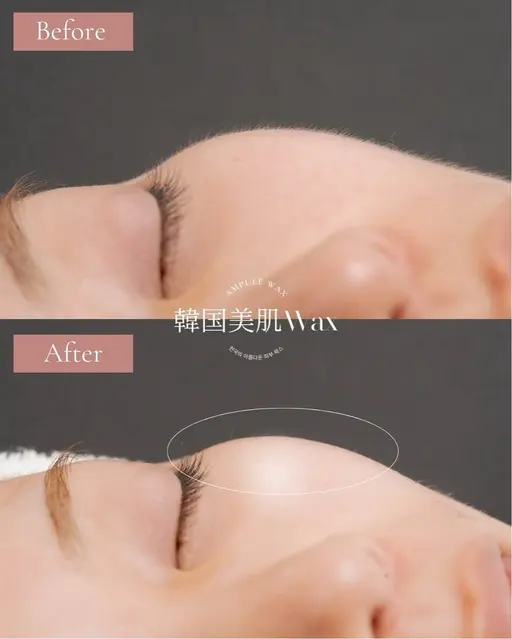 韓国美肌ワックス　（2パーツ）美容液たっぷりのフェイスワックス　おでこor頬or口周りor鼻or顎から2パーツ選べます！