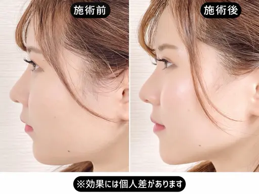 【初回おまかせ】むくみ/エラ/左右差を診断して小顔 60分