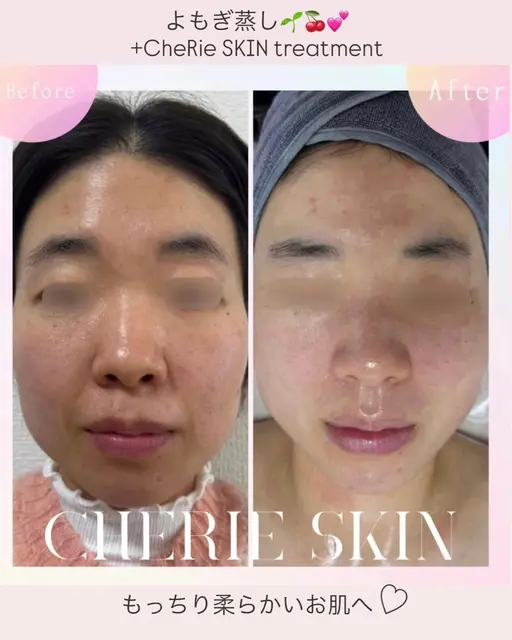 【肌診断付/全身ケア】黄土よもぎ蒸し+選べるフェイシャル《乾燥知らずもっちり艶肌》