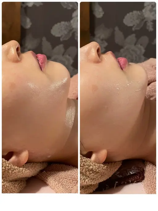 イベント前に🫧“小顔コルセット炭酸パック”寝ている間にお顔の有酸素運動で小顔に😳リピーター様もOK