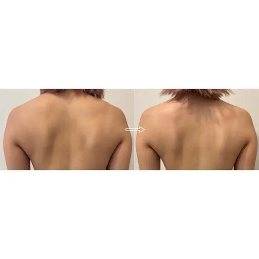 【ミニモ限定】美肌全身リンパマッサージ80分