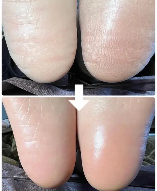 ガチガチかかともつるフワ！足裏角質ケア＋パックコース