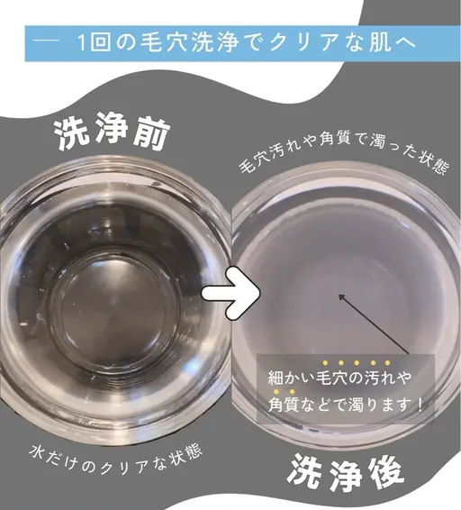 今だけ！【毛穴トラブル・ニキビ・皮脂ベタつき・シミ・しわ】超音波毛穴洗浄➕ビタミンCE導入付き