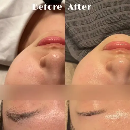 【先着10名🧖🏻‍♀️】ふわもち肌に♡毛穴すっきり洗浄体験🫧