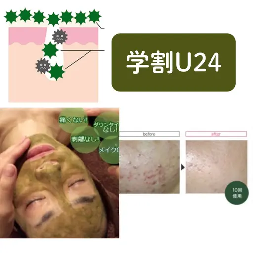 剥離無し🌿漢方ハーブピーリング★¥8000→【学割U24🏫¥5500】