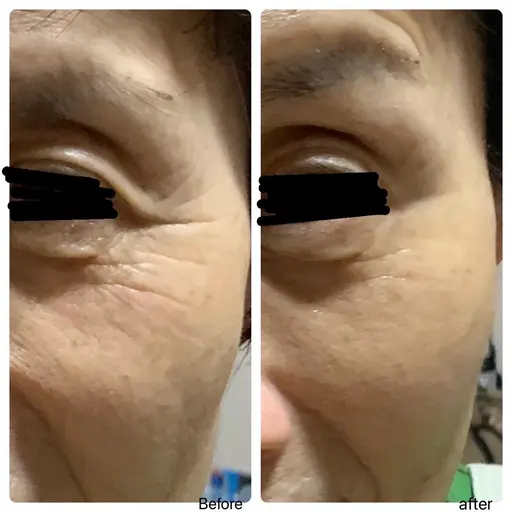 平日限定フェイシャル💆‍♀️