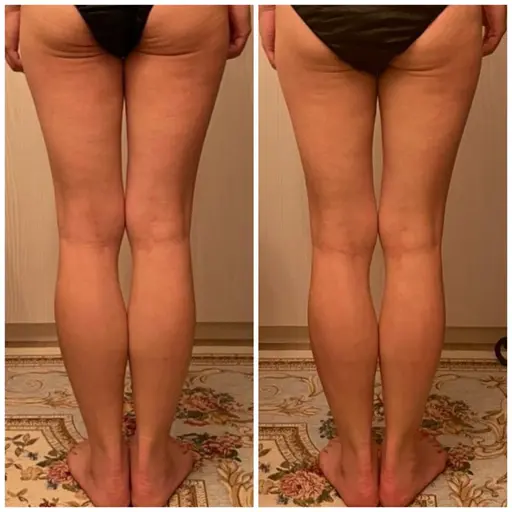 【すぐ予約限定 痩身】ずっしり凸凹脚ほっそり90分