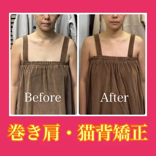 肩こり❤️🔥巻き肩❤️🔥腰痛❤️🔥🌸100分4,400円🌸【上半身×下半身×小顔】通常¥33,000