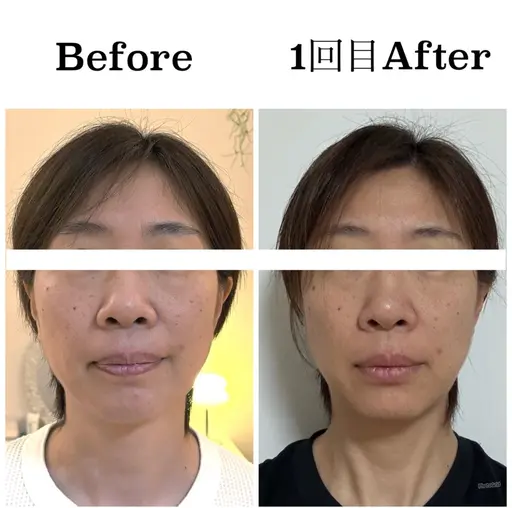 【初回体験無料】40代からのたるみに/土台から整える小顔ケアヘッドスパ付き