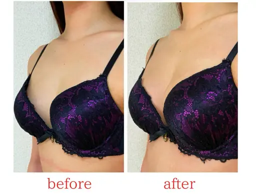 【バストの左右差が気になる】シンメトリーバストケア&全身リンパマッサージ90分