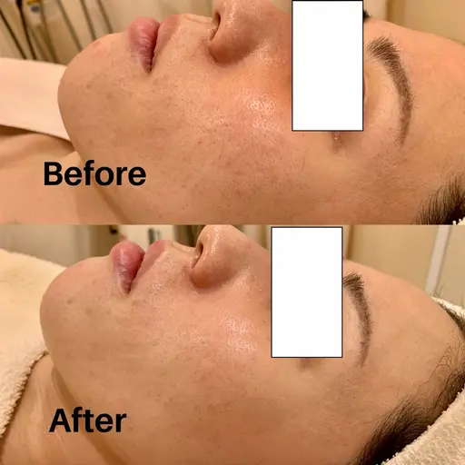 【肌悩み相談はこちら】無料お肌分析＋カウンセリング🌿当日エステOK