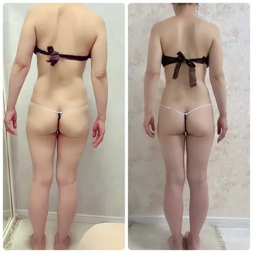 【お試し】全身激変！フルボディ🙋‍♀️【痩身エステ:全身1回コース】