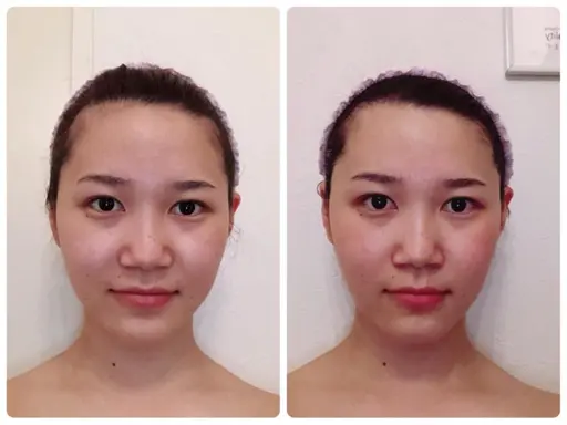 顔+デコルテ＋ヘッドセラピー(ツールなし)