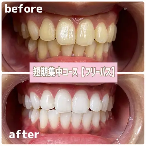 【ペア割!フリーパス】2名様ペアでお得に3週間通い放題👭