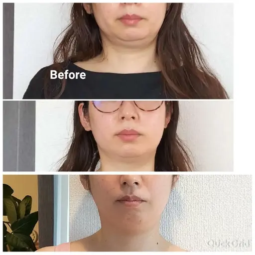 小顔になる♡今から間に合う全身美容！フェイシャルエステつき💆‍♀ツルツル