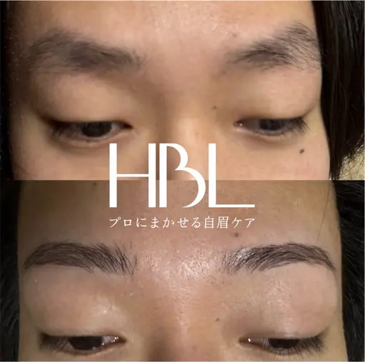 HBL（ハリウッドブロウリフト）＋耳ツボ