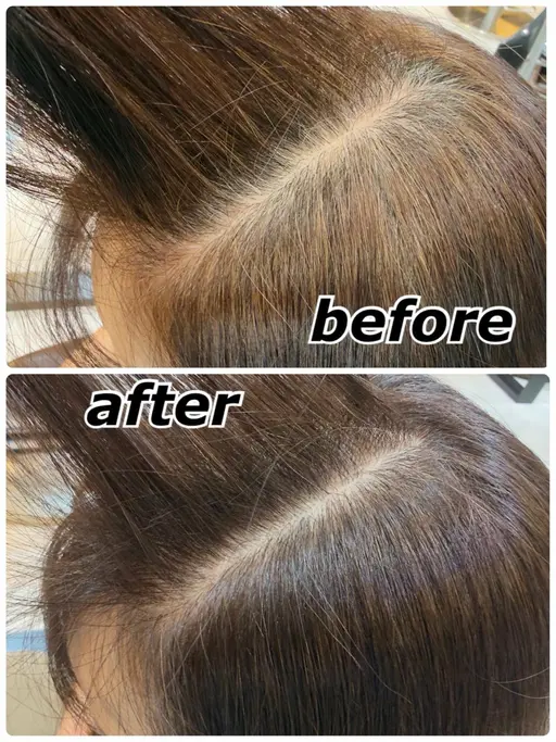 【極上頭浸浴💆‍♀️✨】ヘッドスパで心と身体を癒し爽快感に包まれる贅沢リラックスメニュー🌿ゆったり癒される特別時間