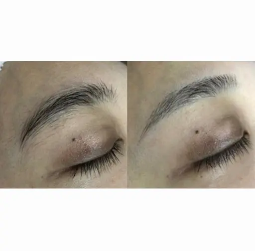 顔、襟レディースシェービング(女性限定)