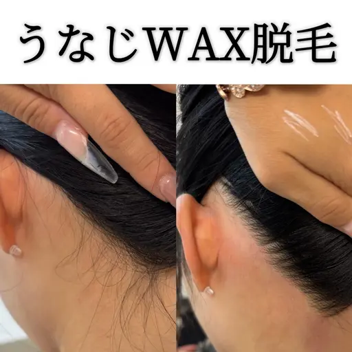 うなじワックス脱毛