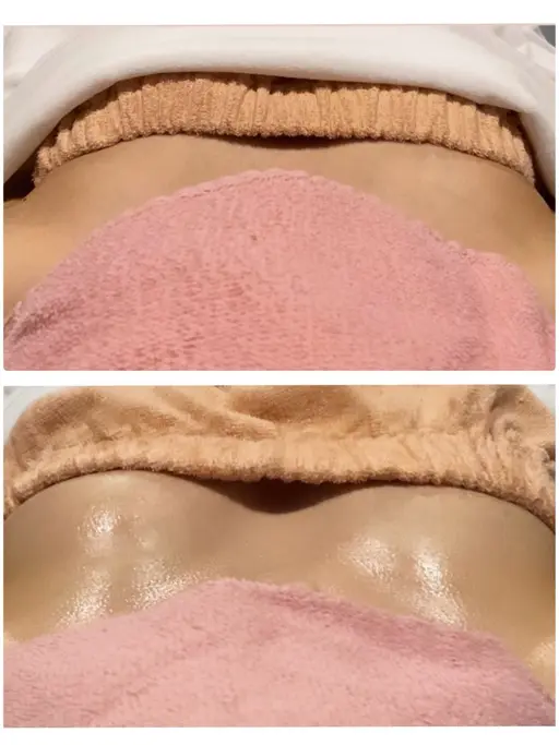 マシュマロバストアップღふわふわもちもち