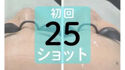 【初回価格】シワ・シミ・くすみなどお顔の部分ケアに 25ショット