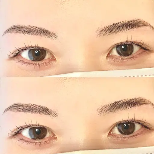 ハリウッドブロウリフト