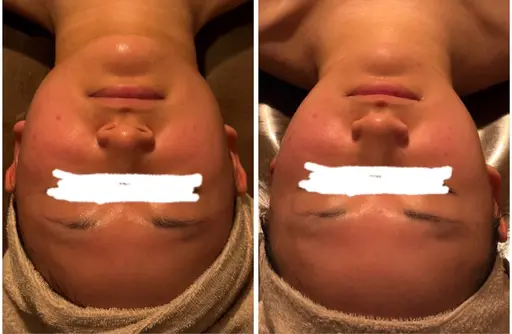 【首を長く、顔は小さく】巻き肩解消×本格オイルコルギ＋デコルテ流し（50分）