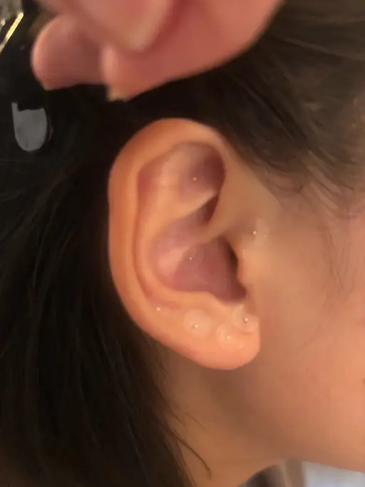 エメラルド式耳ツボリフレクソロジー、耳ツボジュエリー