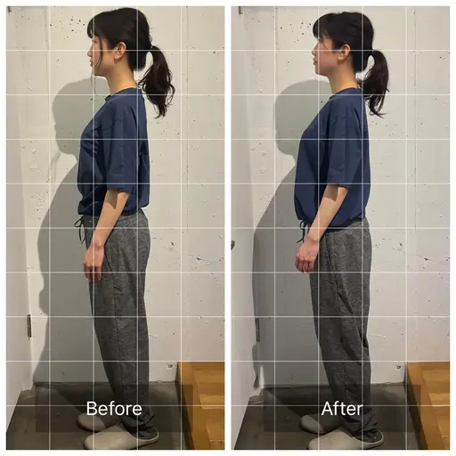 顔のたるみ・左右差/姿勢調整