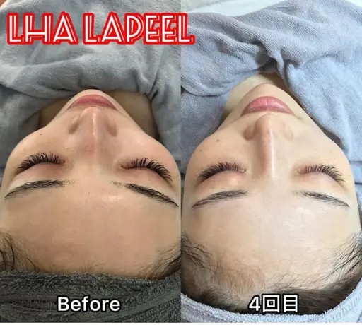 ララピール🇰🇷 (ヘッドM付)¥6,500