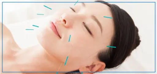 Ｍｅｄｉｃｕｒｅ式美容鍼+頭蓋骨矯正  ※初回限定