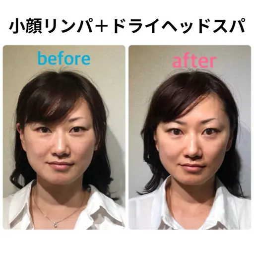 デート前に🩷即効小顔、むくみケア😎小顔リンパ＋ヘッドスパ＋首肩ほぐし⏰90分(メンズ歓迎)ほうれい線/たるみ/美肌