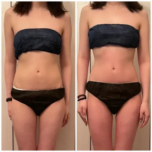 【すぐ予約限定 痩身】くい込み腹、横姿スッキリ60分