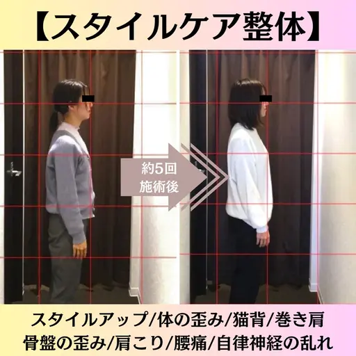 スタイルケア矯正【初めての方はこちら】
