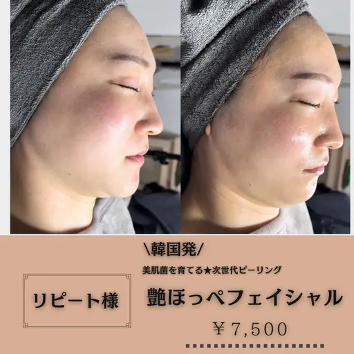 リピーター様★韓国発！次世代ツヤ肌トリートメント